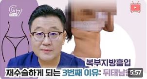 복부 재수술하게 되는 이유