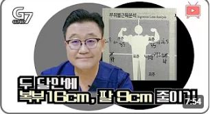 상체 지방흡입의 2달 뒤 효과를 확인해보세요!