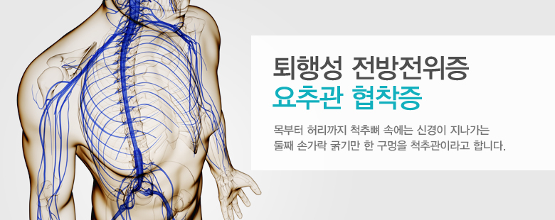 퇴행성 전방전위증 요추관 협착증