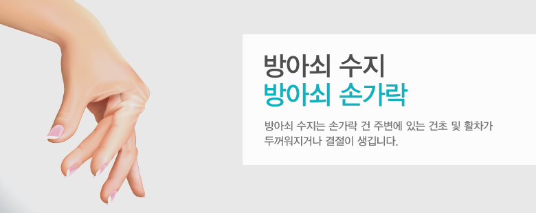 방아쇠 수지 방아쇠 손가락