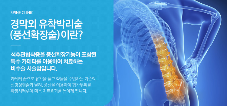 경막외 유착박리술(풍선확장술)이란? 척추관협착증을 풍선확장기능이 포함된 특수 카테터를 이용하여 치료하는 비수술 시술법입니다.