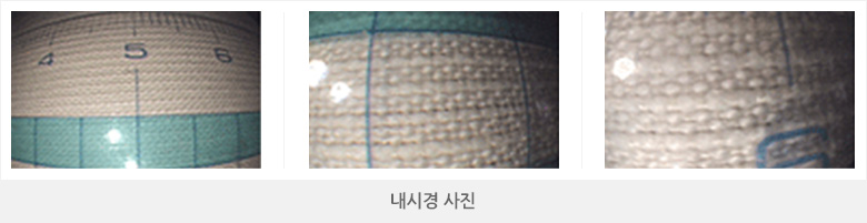 진행성 위암에서 위 궤양으로 진행